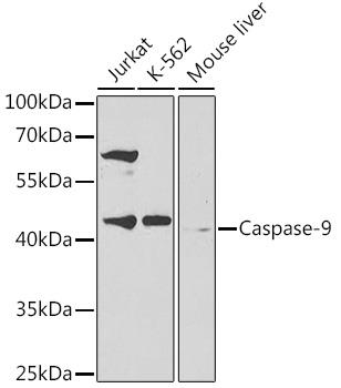 Western blot analysis of extracts of various cell lines, using Caspase-9 antibody at 1:300
dilution.
Secondary antibody: HRP Goat Anti-Rabbit IgG (H+L) at 1:10000 dilution.
Lysates/proteins: 25ug per lane.
Blocking buffer: 3% nonfat dry milk in TBST.
Detection: ECL West Pico Plus.
Exposure time: 60s.
