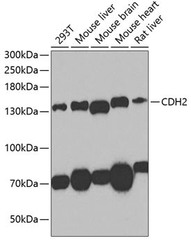 Western blot analysis of extracts of various cell lines, using N-Cadherin antibody at 1:1000 dilution.
Secondary antibody: HRP Goat Anti-Rabbit IgG (H+L) at 1:10000 dilution.
Lysates/proteins: 25ug per lane.
Blocking buffer: 3% nonfat dry milk in TBST.
Detection: ECL West Pico Plus.
Exposure time: 90s.