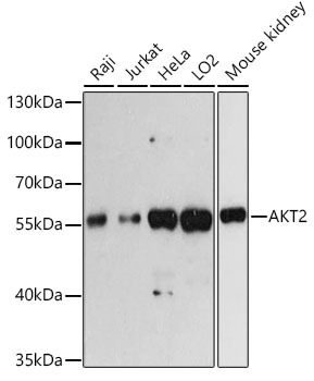 Western blot analysis of extracts of various cell lines, using AKT2 antibody ) at 1:3000
dilution.
Secondary antibody: HRP Goat Anti-Rabbit IgG (H+L)at 1:10000 dilution.
Lysates/proteins: 25ug per lane.
Blocking buffer: 3% nonfat dry milk in TBST.
Detection: ECL West Pico Plus.
Exposure time: 60s.