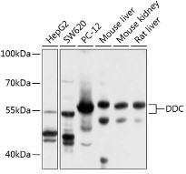 Western blot analysis of extracts of various
cell lines, using DDC antibody at
1:1000 dilution.
Secondary antibody: HRP Goat Anti-Rabbit
IgG (H+L) at 1:10000 dilution.
Lysates/proteins: 25ug per lane.
Blocking buffer: 3% nonfat dry milk in TBST.
Detection: ECL West Pico Plus
Exposure time: 60s.