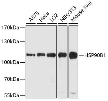 Western blot analysis of extracts of various cell lines, using GRP-94  antibody at 1:1000 dilution.
Secondary antibody: HRP Goat Anti-Rabbit IgG (H+L) at 1:10000 dilution.
Lysates/proteins: 25ug per lane.
Blocking buffer: 3% nonfat dry milk in TBST.
Detection: ECL West Pico Plus.
Exposure time: 90s.
