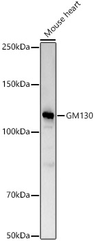Western blot analysis of Mouse heart, using GM130 antibody at 1:2000 dilution.
Secondary antibody: HRP Goat Anti-Rabbit IgG (H+L) at 1:10000 dilution.
Lysates/proteins: 25μg per lane.
Blocking buffer: 3% nonfat dry milk in TBST.
Detection: ECL West Pico Plus.
Exposure time: 60s.