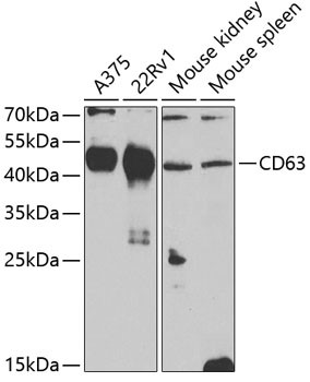 Western blot analysis of extracts of various cell line, using CD63
at 1:1,000 dilution.
Secondary antibody: HRP Goat Anti-Rabbit IgG (H+L) at 1:10,000 dilution.
Lysates/proteins: 25ug per lane.
Blocking buffer: 3% nonfat dry milk in TBST.
Detection: ECL West Pico Kit.
Exposure time: 15s