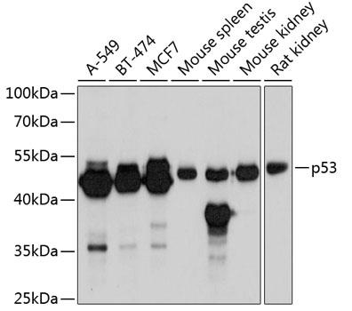 Western blot analysis of extracts of various cell lines, using p53 antibody  at 1:6000 dilution.
Secondary antibody: HRP Goat Anti-Rabbit IgG (H+L) at 1:10000 dilution.
Lysates/proteins: 25ug per lane.
Blocking buffer: 3% nonfat dry milk in TBST.
Detection: ECL West Pico Plus.
Exposure time: 15s.