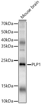 Western blot analysis of various lysates, using PLP1 Rabbit pAb at 1:2000dilution.
Secondary antibody: HRP-conjugated Goat anti-Rabbit IgG (H+L) at 1:10000dilution.
Lysates/proteins: 25μg per lane.
Blocking buffer: 3% nonfat dry milk in TBST.
Detection: ECL West Pico Plus.
Exposure time: 30s.