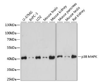 Westen blot analysis of extracts of various
cell lines, using p38 MAPK antibody at
1:1000 dilution. Secondary antibody: HRP
Goat Anti-Rabbit IgG (H+L) at 1:10000
dilution.
Lysates/proteins: 25ug per lane. Blocking
buffer: 3% nonfat dry milk in TBST.
Detection: ECL West Pico Plus. Exposure
time: 30s.