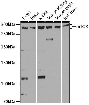 Western blot analysis of extracts of various cell lines, using mTOR antibody at 1:1000 dilution.
Secondary antibody: HRP Goat Anti-Rabbit IgG (H+L) at 1:10000 dilution.
Lysates/proteins: 25ug per lane.
Blocking buffer: 3% nonfat dry milk in TBST.
Detection: ECL West Femto Plus
Exposure time: 15s