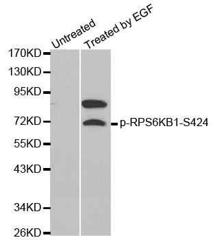 Western blot analysis of extracts from MCF cells using Phospho- P70-S6K -S424 antibody.