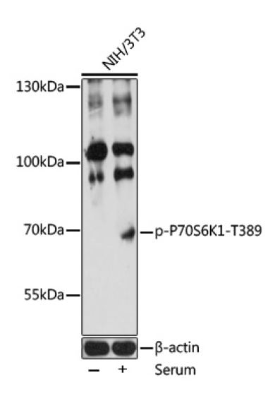 Western blot analysis of extracts of NIH/3T3 cells, using Phospho-P70S6K1-T389 at 1:1000 dilution.NIH/3T3 cells were treated by 10% FBS at 37℃ for 30 minutes after serum-starvation overnight. Secondary antibody: HRP Goat Anti-Rabbit IgG (H+L) at 1:10000 dilution. Lysates/proteins: 25ug per lane. Blocking buffer: 3% BSA. Detection: ECL West Pico Plusa Exposure time: 10s.
