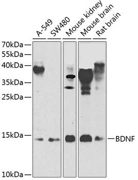 Western blot analysis of extracts of
various cell lines, using BDNF antibody
at 1:1000 dilution.
Secondary antibody: HRP Goat Anti-
Rabbit IgG (H+L) at 1:10000
dilution.
Lysates/proteins: 25ug per lane.
Blocking buffer: 3% nonfat dry milk in
TBST.
Detection: ECL West Pico Kit.
Exposure time: 90s.