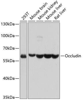 Western blot analysis of extracts of  various cell lines, using Occludin
antibody at 1:1000 dilution.
Secondary antibody: HRP Goat Anti- Rabbit IgG (H+L) at 1:10000 dilution.
Lysates/proteins: 25ug per lane.
Blocking buffer: 3% nonfat dry milk in TBST.
Detection: ECL West Pico Plus   
Exposure time: 1s.