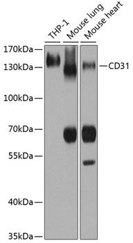 Western blot analysis of extracts of various cell lines, using CD31
antibody at 1:1000 dilution. Secondary antibody: HRP Goat Anti- Rabbit IgG (H+L) at 1:10000
dilution.
Lysates/proteins: 25ug per lane.
Blocking buffer: 3% nonfat dry milk in TBST.
Detection: ECL West Pico Plus.
Exposure time: 3s.