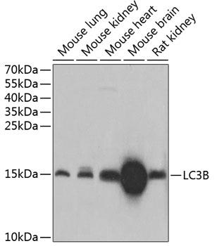 Western blot analysis of extracts of various cell lines, using LC3B antibody at 1:1000dilution.
Secondary antibody: HRP Goat Anti-Rabbit IgG (H+L) at 1:10000 dilution.
Lysates/proteins: 25ug per lane.
Blocking buffer: 3% nonfat dry milk in TBST.Detection: ECL West Pico Plus. Exposure time: 30s..