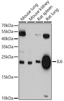 Western blot analysis of extracts of various cell lines, using IL6 antibody at 1:3000 dilution. Secondary antibody: HRP Goat Anti-Rabbit IgG (H+L) at 1:10000 dilution.
Lysates/proteins: 25ug per lane.
Blocking buffer: 3% nonfat dry milk in TBST. Detection: ECL West Pico Plus.Exposure time: 90.