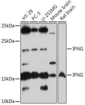 Western blot analysis of extracts of
various cell lines, using IFNG antibody
at 1:1000 dilution.
Secondary antibody: HRP Goat Anti-
Rabbit IgG (H+L) at 1:10000
dilution.
Lysates/proteins: 25ug per lane.
Blocking buffer: 3% nonfat dry milk in
TBST.
Detection: ECL West Pico Plus 
Exposure time: 60s.