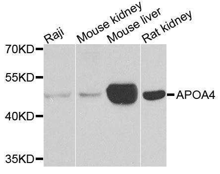 Western blot analysis of extracts of
various cell lines, using APOA IV
antibody at 1:1000 dilution.
Secondary antibody: HRP Goat Anti-
Rabbit IgG (H+L) at 1:10000
dilution.
Lysates/proteins: 25ug per lane.
Blocking buffer: 3% nonfat dry milk in
TBST.
Detection: ECL Basic Kit
Exposure time: 10s.