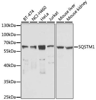 Western blot analysis of extracts of various cell lines, using 62/SQSTM1 antibody at 1:1000 dilution.
Secondary antibody: HRP Goat Anti-Rabbit IgG (H+L) at 1:10000 dilution.
Lysates/proteins: 25ug per lane.
Blocking buffer: 3% nonfat dry milk in TBST.
Detection: ECL West Pico Kit.     
Exposure time: 10s.