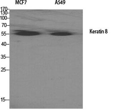 Western Blot analysis of various cells using Cytokeratin 8 Polyclonal Antibody diluted at 1:2000