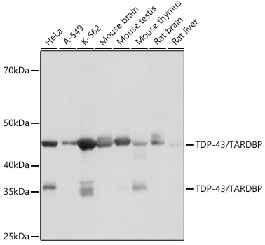 Western blot analysis of various lysates using TDP-43/TARDBP Rabbit pab at 1:1000 dilution.
Secondary antibody: HRP Goat Anti-Rabbit IgG (H+L) at 1:10000 dilution.
Lysates/proteins: 25μg per lane.
Blocking buffer: 3% nonfat dry milk in TBST.
Detection: ECL West Pico Plus.
Exposure time: 10s.