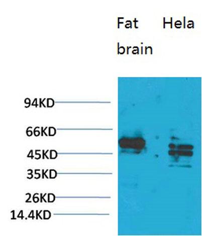 Western blot analysis of 1) Rat Brain Tissue, 2)Hela, with CXCR4 Rabbit pAb diluted at 1:1,000.