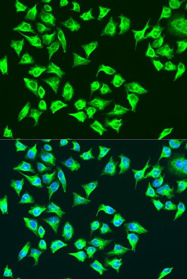 Western blot analysis of extracts of various cell lines, using ATP6 antibody at 1:1000 dilution.
Secondary antibody: HRP Goat Anti-Rabbit IgG (H+L)
(at 1:10000 dilution).
Lysates/proteins: 25ug per lane.
Blocking buffer: 3% nonfat dry milk in TBST.
Detection: ECL Enhanced Kit 
Exposure time: 10s.