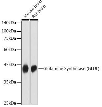 Western blot analysis of extracts of various cell lines, using Glutamine Synthetase (GLUL) antibody at 1:1000 dilution.
Secondary antibody: HRP Goat Anti-Rabbit IgG (H+L) at 1:10000 dilution.
Lysates/proteins: 25ug per lane. Blocking buffer: 3% nonfat dry milk in TBST.
Detection: ECL West Pico Plus. Exposure time: 5s..