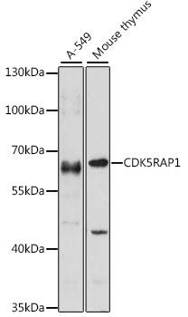 Western blot analysis of extracts of various cell lines, using CDK5RAP1 antibody at 1:1000 dilution.
Secondary antibody: HRP Goat Anti-Rabbit IgG (H+L) at 1:10,000 dilution.
Lysates/proteins: 25ug per lane.
Blocking buffer: 3% nonfat dry milk in TBST.
Detection: ECL Enhanced Kit.
Exposure time: 30s.