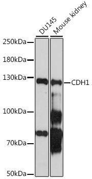 Western blot analysis of extracts of various cell lines, using CDH1 antibody at 1:1000 dilution.
Secondary antibody: HRP Goat Anti-Rabbit IgG (H+L)at 1:10000 dilution.
Lysates/proteins: 25ug per lane.
Blocking buffer: 3% nonfat dry milk in TBST.
Detection: ECL Basic Kit.
Exposure time: 90s.