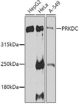 Western blot analysis of extracts of various cell lines, using DNA-PKCS antibody at 1:1000 dilution.
Secondary antibody: HRP Goat Anti-Rabbit IgG (H+L) at 1:10000 dilution.
Lysates/proteins: 25ug per lane.
Blocking buffer: 3% nonfat dry milk in TBST.
Detection: ECL West Pico Plus.
Exposure time: 90s.