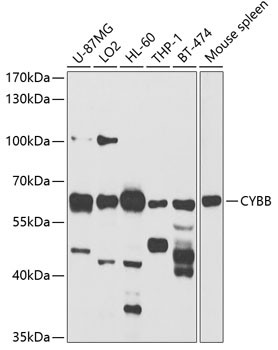 Western blot analysis of extracts of various cell lines, using
Nox2 antibody at 1:1000 dilution.
Secondary antibody: HRP Goat Anti-Rabbit IgG (H+L) at 1:10000 dilution.
Lysates/proteins: 25ug per lane.
Blocking buffer: 3% nonfat dry milk in TBST.
Detection: ECL West Pico Kit Exposure time: 60s.