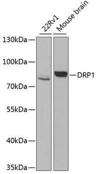 Western blot analysis of extracts of various cell lines, using DRP1 antibody at 1:1000 dilution.
Secondary antibody: HRP Goat Anti-Rabbit IgG (H+L) at 1:10000 dilution.
Lysates/proteins: 25ug per lane.
Blocking buffer: 3% nonfat dry milk in TBST.
Detection: ECL Basic Kit.