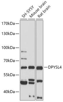 Western blot analysis of extracts of various cell lines, using DPYSL4 antibody at 1:1000 dilution.
Secondary antibody: HRP Goat Anti-Rabbit IgG (H+L) at 1:10000 dilution.
Lysates/proteins: 25ug per lane.
Blocking buffer: 3% nonfat dry milk in TBST.
Detection: ECL West Pico.
Exposure time: 30s.