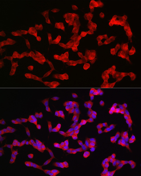 Immununofluorescence analysis of SH-SY5Y cells using ANK3 Rabbit pAb at dilution of 1:100 (40x lens). 
Blue: DAPI for nuclear staining.
