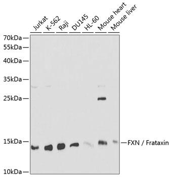 Western blot analysis of extracts of various cell lines, using FXN / Frataxin antibody at 1:1000 dilution.
Secondary antibody: HRP Goat Anti-Rabbit IgG (H+L) at 1:10000 dilution.
Lysates/proteins: 25ug per lane.
Blocking buffer: 3% nonfat dry milk in TBST.