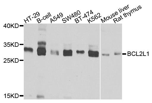 Western blot analysis of extracts of
various cell lines, using BCL2L1
antibody at 1:1000 dilution.
Secondary antibody: HRP Goat Anti-
Rabbit IgG (H+L) at 1:10000
dilution.
Lysates/proteins: 25ug per lane.
Blocking buffer: 3% nonfat dry milk in
TBST.
Detection: ECL West Pico Plus.
Exposure time: 15s.
