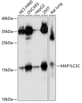 Western blot analysis of extracts of
various cell lines, using LC3C
antibody at 1:1000 dilution.
Secondary antibody: HRP Goat Anti-
Rabbit IgG (H+L) at 1:10000
dilution.
Lysates/proteins: 25ug per lane.
Blocking buffer: 3% nonfat dry milk in
TBST.
Detection: ECL West Pico Plus.
Exposure time: 90s.