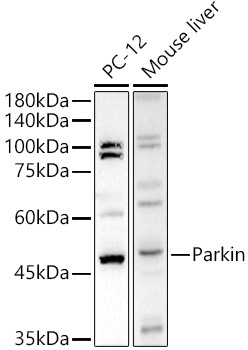 Western blot analysis of extracts of various cell lines, using Parkin antibody at 1:500 dilution.
Secondary antibody: HRP Goat Anti-Rabbit IgG (H+L) at 1:10000 dilution.
Lysates/proteins: 25μg per lane.
Blocking buffer: 3% nonfat dry milk in TBST.
Detection: ECL Basic Kit.
Exposure time: 180s
