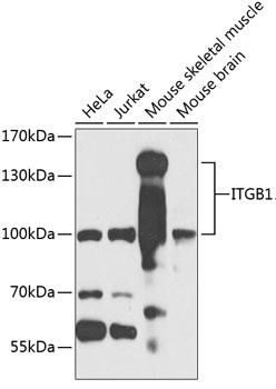 Western blot analysis of extracts of various cell lines, using ITGB1 antibody at 1:1000 dilution.
Secondary antibody: HRP Goat Anti-Rabbit IgG (H+L) at 1:10000 dilution.
Lysates/proteins: 25ug per lane.
Blocking buffer: 3% nonfat dry milk in TBST.
Detection: ECL West Pico Plus 
Exposure time: 90s.