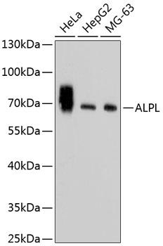 Western blot analysis of extracts of various cell lines, using ALPL antibody
Secondary antibody: HRP Goat Anti-Rabbit IgG (H+L) at 1:10000 dilution.
Lysates/proteins: 25ug per lane.
Blocking buffer: 3% nonfat dry milk in TBST.