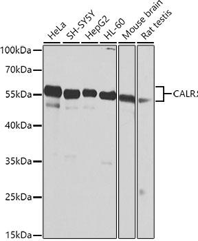 Western blot analysis of extracts of
various cell lines, using CALR antibody
 at 1:1000 dilution.
Secondary antibody: HRP Goat Anti-
Rabbit IgG (H+L) at 1:10000
dilution.
Lysates/proteins: 25ug per lane.
Blocking buffer: 3% nonfat dry milk in
TBST.
Detection: ecl WEST Pico Plus 
Exposure time: 1s.