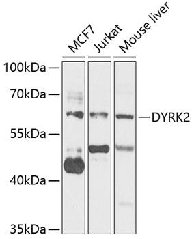 Western blot analysis of extracts of
various cell lines, using DYRK2
antibody at 1:1000 dilution.
Secondary antibody: HRP Goat Anti-
Rabbit IgG (H+L) at 1:10000
dilution.
Lysates/proteins: 25ug per lane.
Blocking buffer: 3% nonfat dry milk in
TBST.
Detection: ECL West Pico Plus.
Exposure time: 5s.