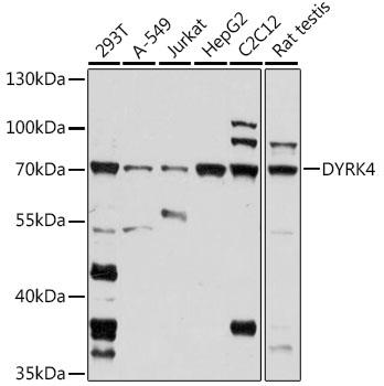 Western blot analysis of extracts of
various cell lines, using DYRK4
antibody at 1:1000 dilution.
Secondary antibody: HRP Goat Anti-
Rabbit IgG (H+L) at 1:10000
dilution.
Lysates/proteins: 25ug per lane.
Blocking buffer: 3% nonfat dry milk in
TBST.
Detection: ECL West Pico Plus.  
Exposure time: 60s.