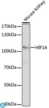 Western Blot analysis of AB-84138