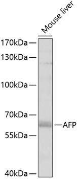 Western blot analysis of extracts of mouse liver,
using AFP antibody at 1:1000 dilution.
Secondary antibody: HRP Goat Anti-Rabbit IgG
(H+L) at 1:10000 dilution.
Lysates/proteins: 25ug per lane.
Blocking buffer: 3% nonfat dry milk in TBST.
Detection: ECL Enhanced Kit.
Exposure time: 60s