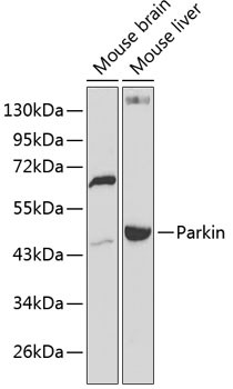 Western blot analysis of extracts of 
various cell lines, using AQP8 antibody at 1:1000 dilution._
Secondary antibody: HRP Goat Anti-Rabbit IgG (H+L)  at 1:10000 dilution._
Lysates/proteins:
25ug per lane._
Blocking buffer: 3% nonfat dry milk in TBST._Detection:
ECL West Pico Plus.
Exposure  time: 90s.