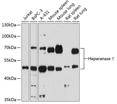 Western blot analysis of extracts of
various cells, using Heparanase 1
antibody at 1:1000 dilution.
Secondary antibody: HRP Goat Anti-
Rabbit IgG (H+L) at 1:10000
dilution.
Lysates/proteins: 25ug per lane.
Blocking buffer: 3% nonfat dry milk in
TBST.
Detection: ECL Basic Kit.
Exposure time: 30s.