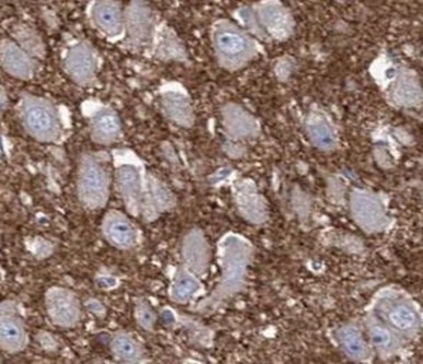 Immunohistochemistry of paraffin-embedded human pancreas tissue slide 1:200