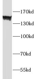 HL-60 cells were subjected to SDS PAGE followed by western blot with F4/80 Antibody at dilution of 1:1000