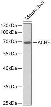 Western blot analysis of extracts of
mouse liver, using ACHE antibody
Secondary antibody: HRP Goat Anti-
Rabbit IgG (H+L) at 1:10000
dilution.
Lysates/proteins: 25ug per lane.
Blocking buffer: 3% nonfat dry milk in
TBST.