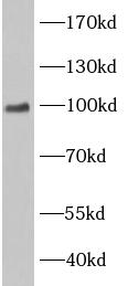 mouse spleen were subjected to SDS PAGE followed by western blot with (EWSR1 antibody) at dilution of 1:1000